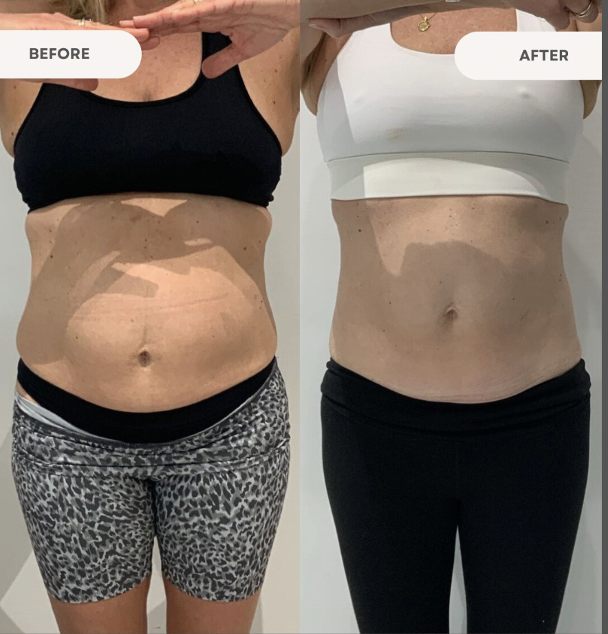 Product transformation